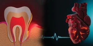 دندانپزشکی ایمن برای بیماران قلبی
