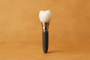 لمینت و سرامیک دندان اقساطی