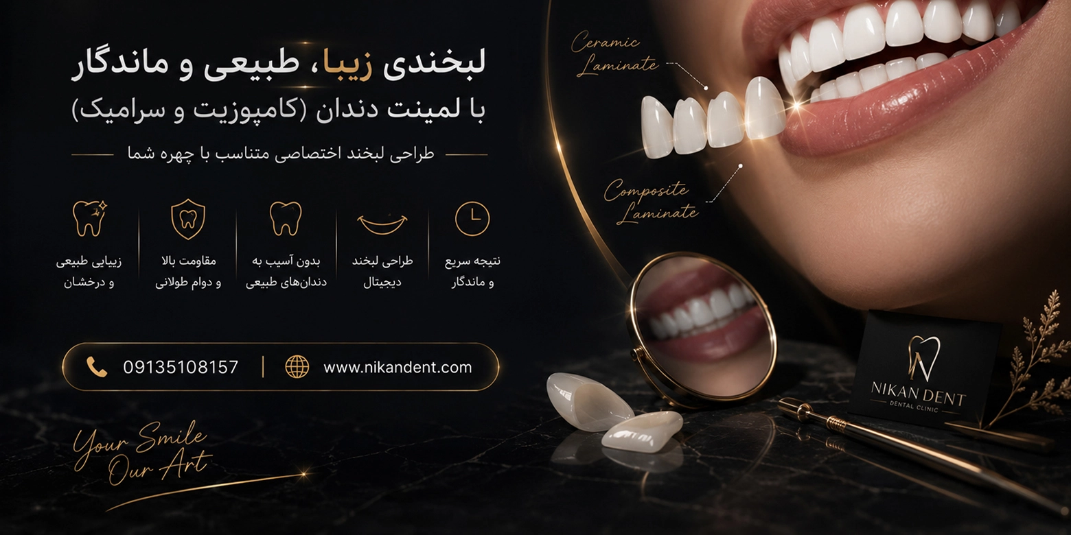 دندانپزشکی نزدیک بیمارستان قلب چمران | نیکاندنت – دکتر ندا قاسمی 2 اسلایدر نیکان دنت - لمینت