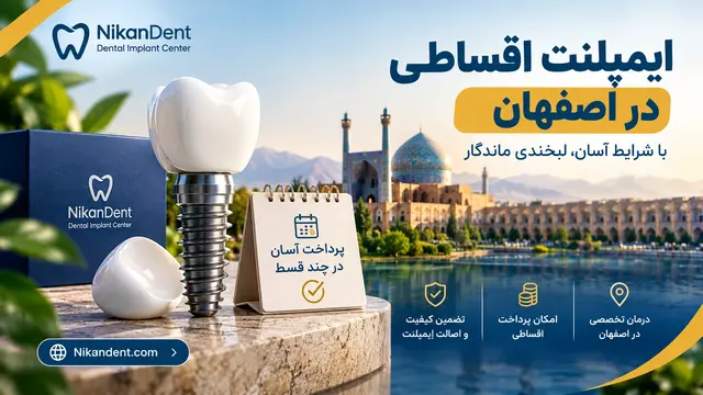 ایمپلنت اقساطی در اصفهان ؛ شرایط و هزینه 1 ایمپلنت اقساطی در اصفهان