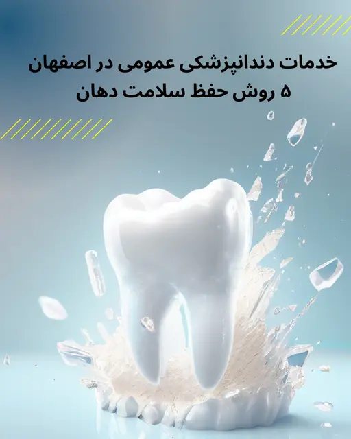 خدمات دندانپزشکی عمومی در اصفهان